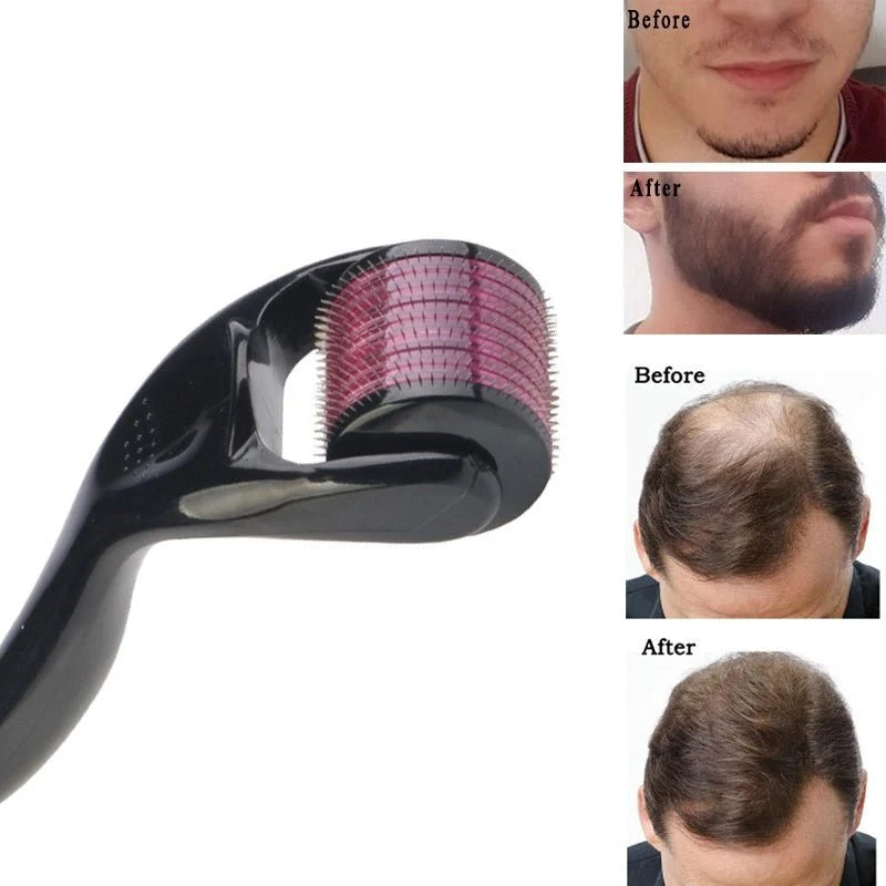 Roller System