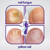 Jaysuin - Nail Fungus Spray